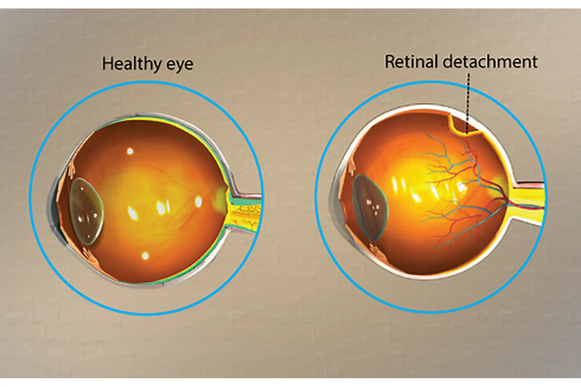[Sigh Energy] Заживление и регенерация сетчатки. Retinal Healing and Regeneration Powerful, фото 1 из 1.