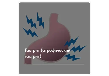 Лечебный протокол «Гастрит. Атрофический гастрит». Тариф Без обратной связи (Елена Ержанова)