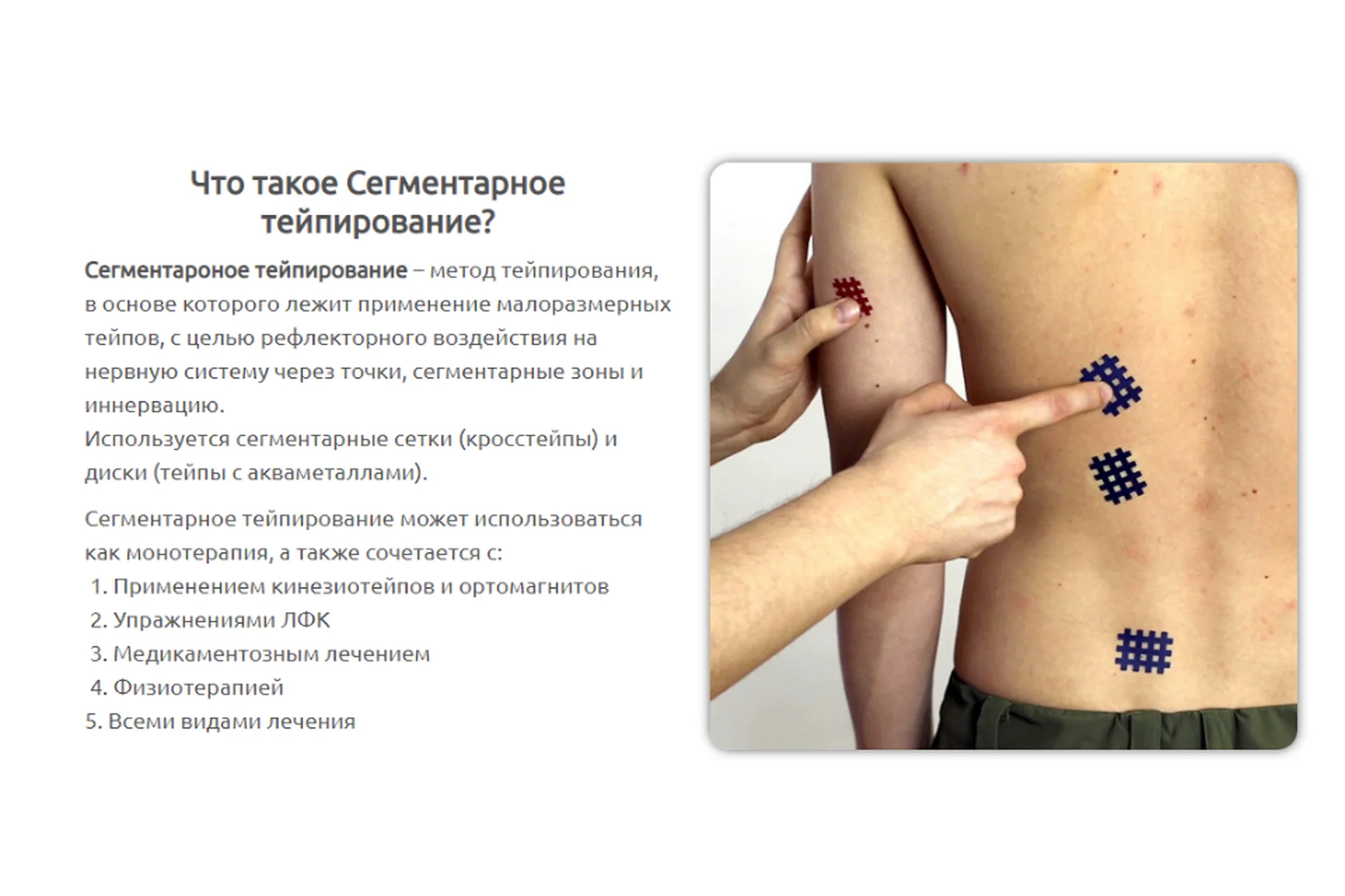 Сегментарное тейпирование, комплект Профи (Евгений Харламов), фото 1 из 1.