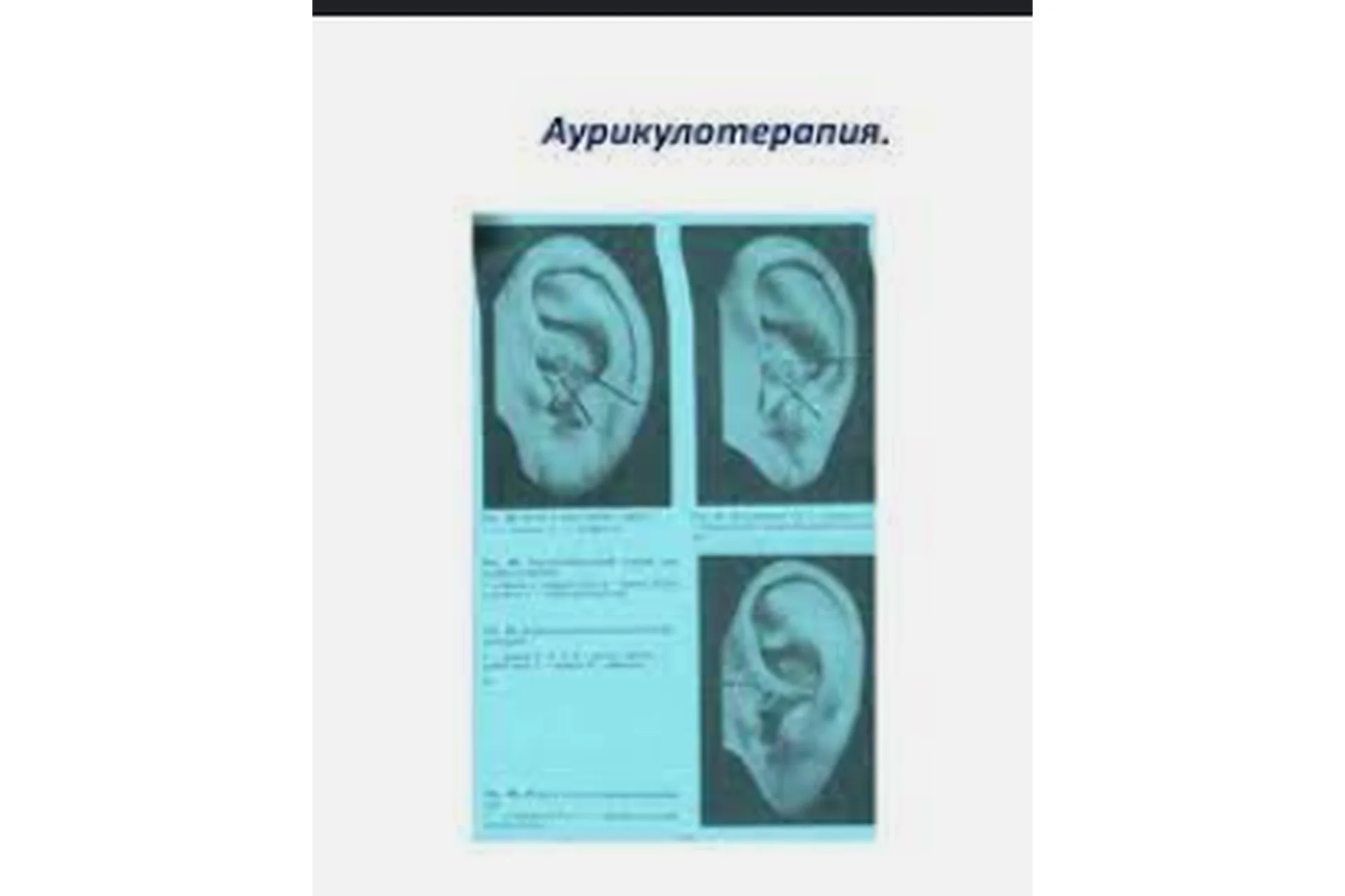 Клиническая аурикулотерапия (Елена Шведова), фото 1 из 1.