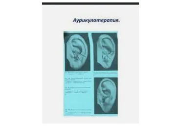 Клиническая аурикулотерапия (Елена Шведова)