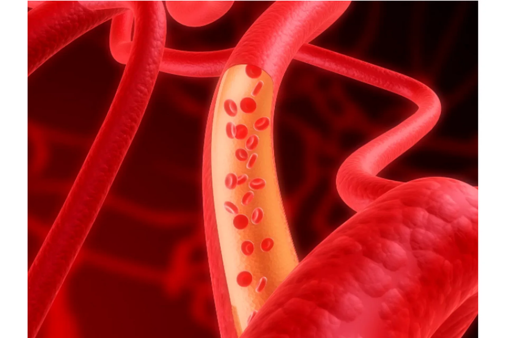 Сосудистый тренинг (Елена Симутина), фото 1 из 1.