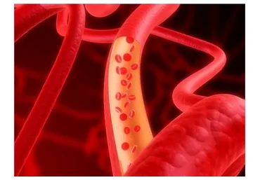 Сосудистый тренинг (Елена Симутина)