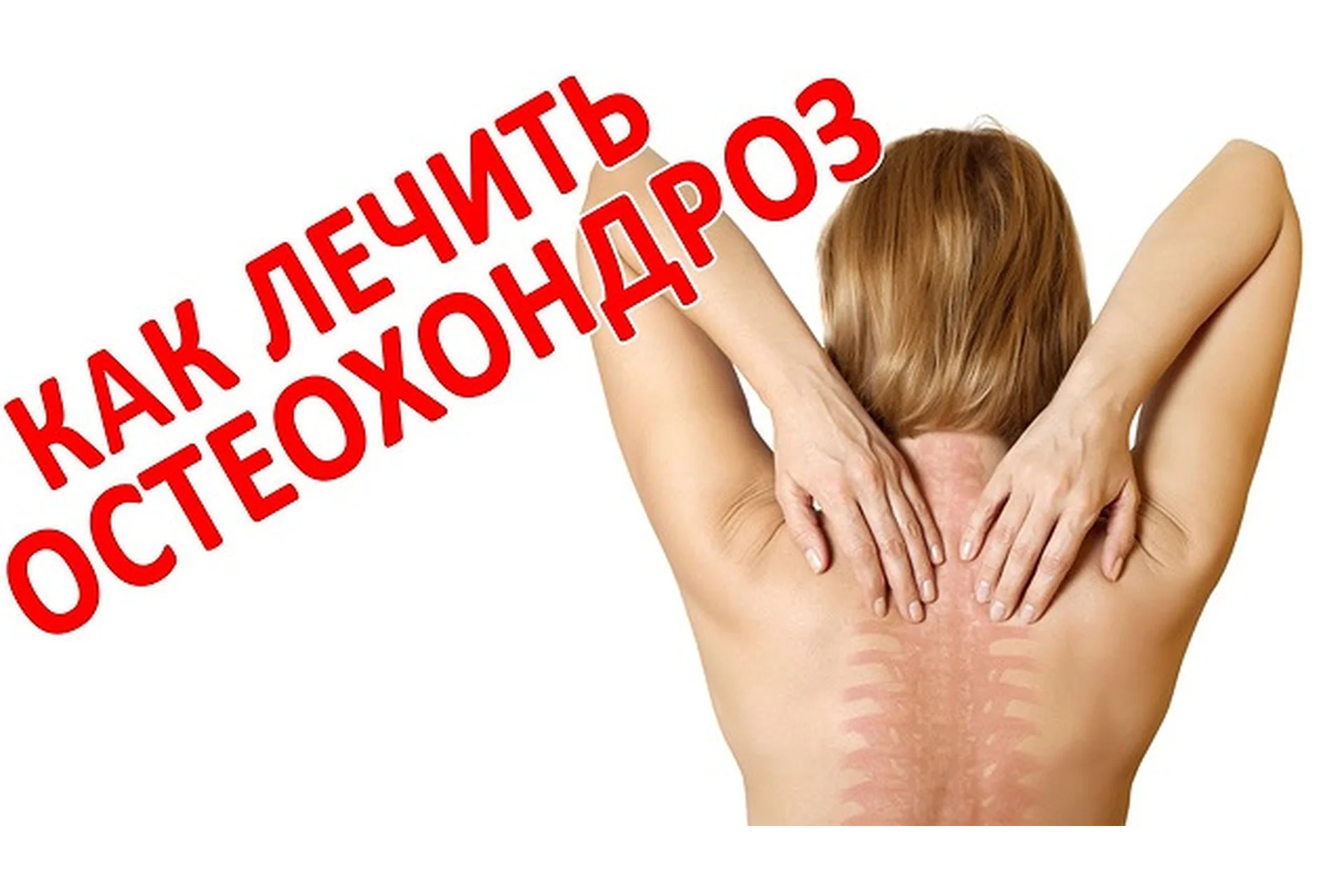 [Интераура] Лечение и профилактика: Остеохондроз, фото 1 из 1.