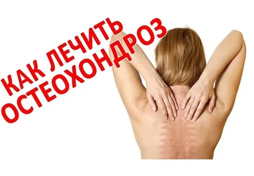 [Интераура] Лечение и профилактика: Остеохондроз