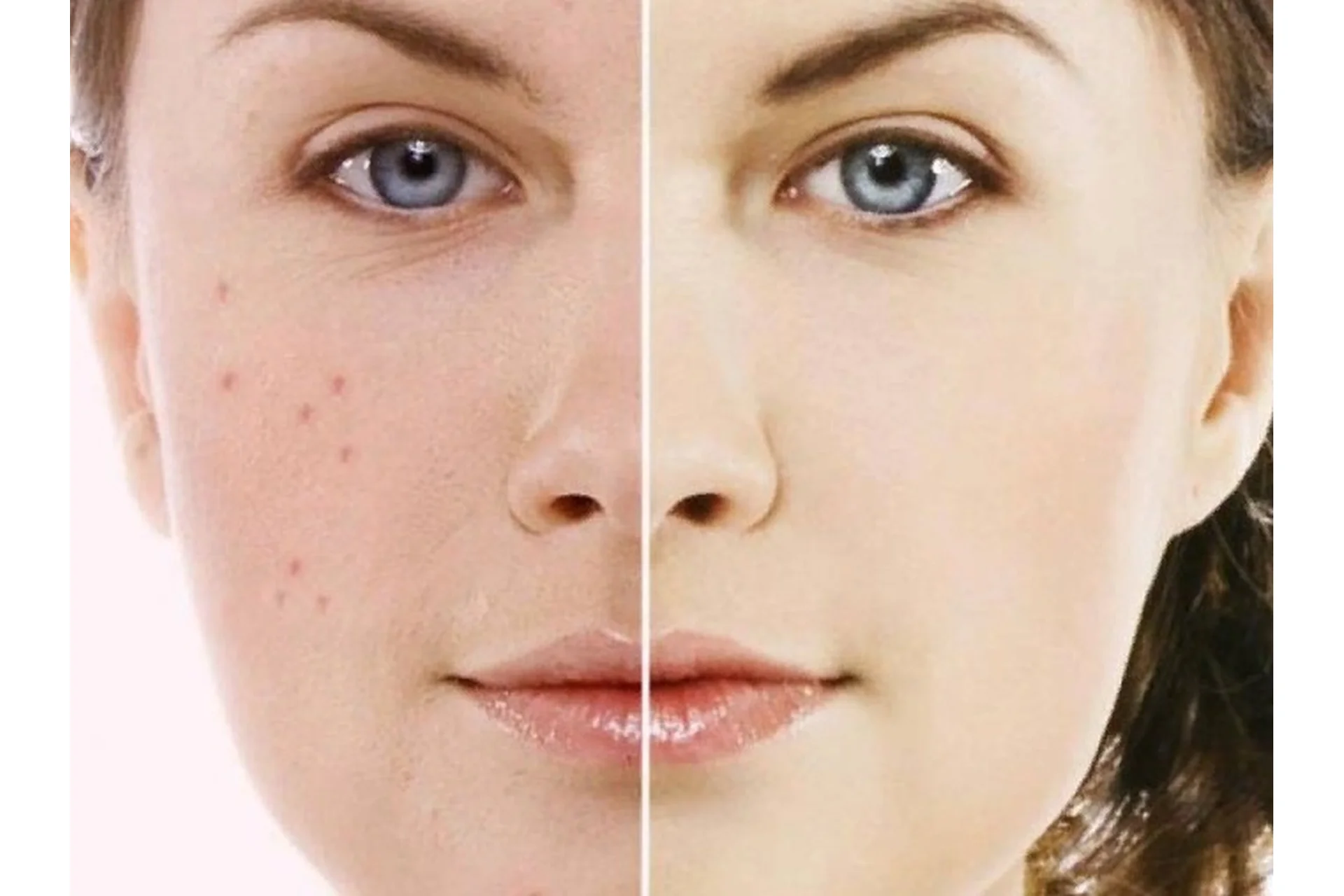 [Alhimik School] Жирная кожа, пакет «Эконом» (Наталия Ткаченко), фото 1 из 1.