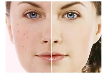 [Alhimik School] Жирная кожа, пакет «Эконом» (Наталия Ткаченко)