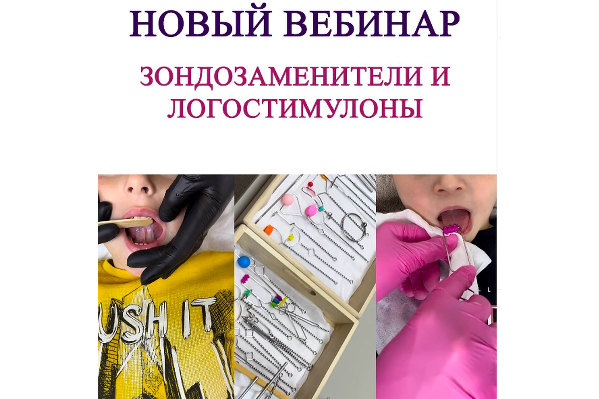 Зондозаменители и логостимулоны в работе логопеда (Ангелина Сыщенко), фото 1 из 1.