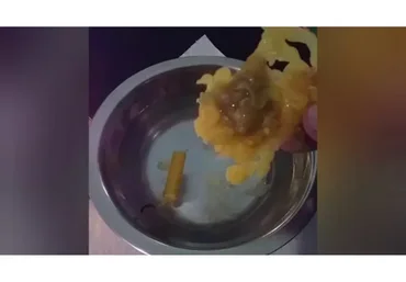 Диагностика негатива восковыми отливками (Радомира)