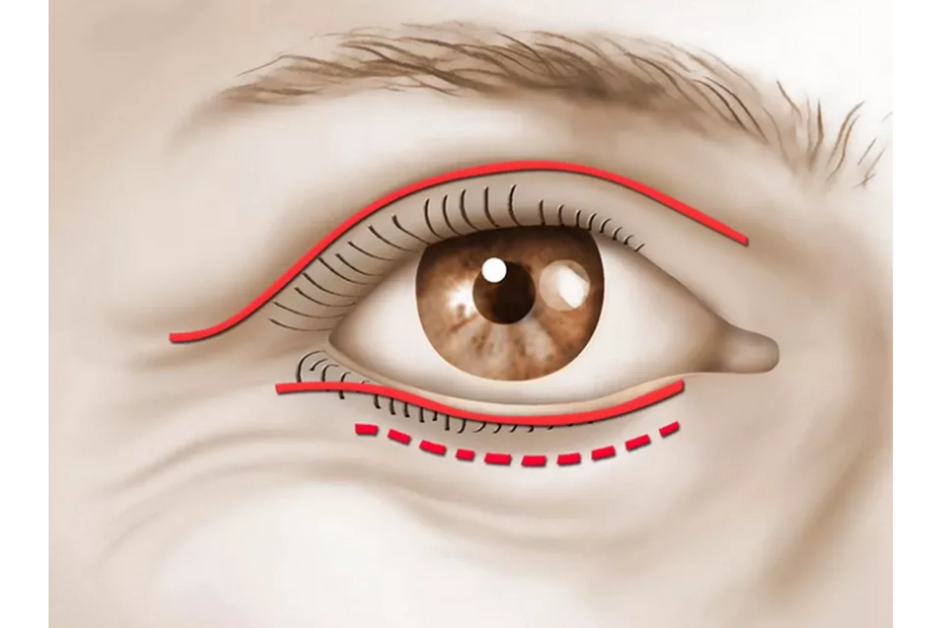 Верхние и нижние веки (Светлана Соковикова), фото 1 из 1.