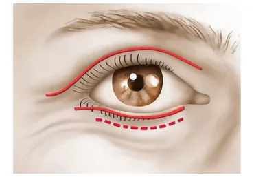 Верхние и нижние веки (Светлана Соковикова)