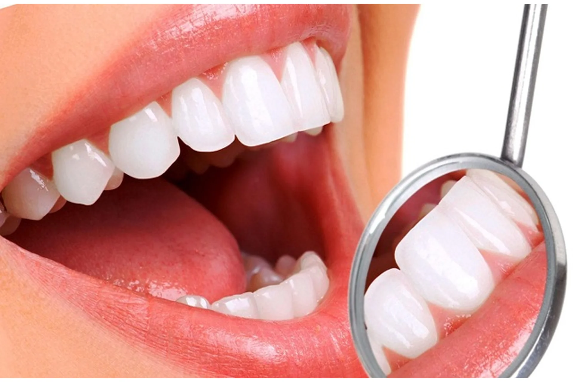 [Интераура] Лечение и профилактика: Пародонтит, фото 1 из 1.