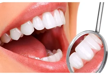 [Интераура] Лечение и профилактика: Пародонтит