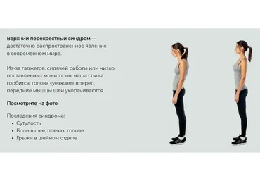 [Anatomy Study] Верхний перекрестный синдром (Сергей Скворцов, Александр Семенов)