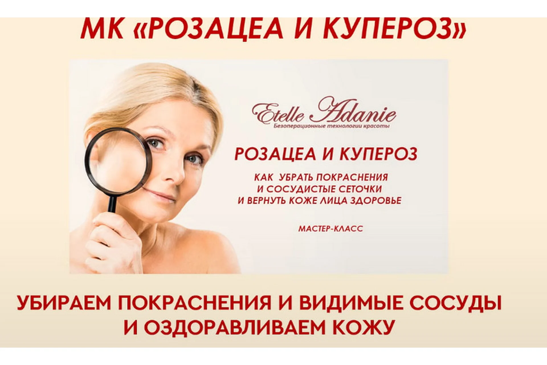 Розацеа и Купероз. Тариф - Розацеа + Купероз (Этель Аданье), фото 1 из 1.