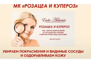 Розацеа и Купероз. Тариф - Розацеа + Купероз (Этель Аданье)