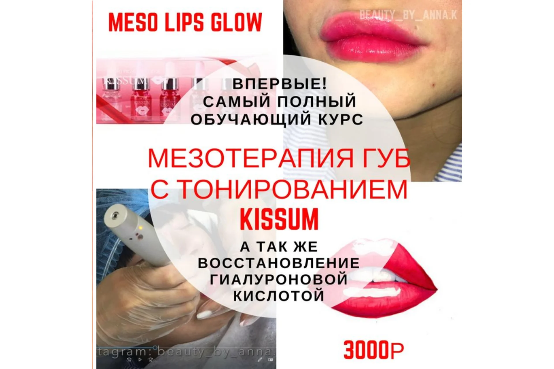 [beauty_shop.bb_glow] Мезотерапия губ с тонированием KISSUM (Анна Караваева), фото 1 из 1.