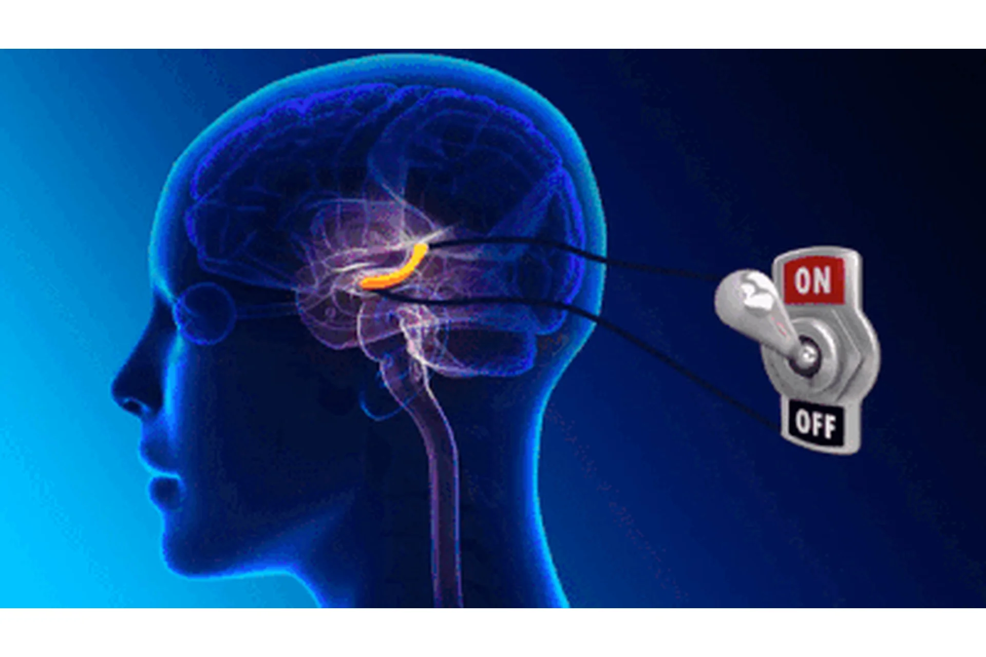 Антистарение мозга (Михаил Батин), фото 1 из 1.