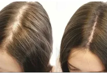 Волосы, февраль 2020 (Елена Корнилова)