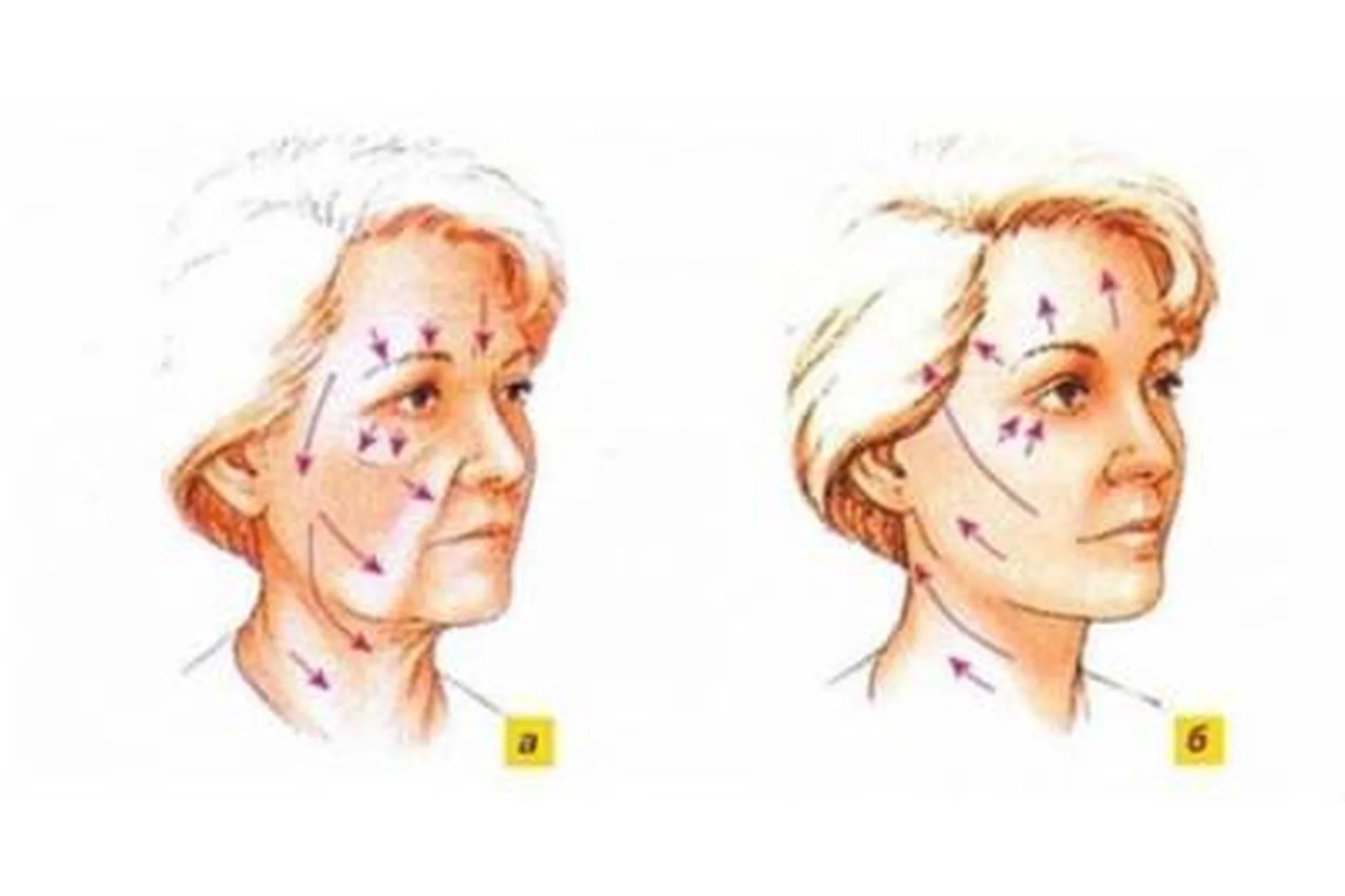 Эстетический реоформинг и кинезиотейпинг лица (Евгений Литвиченко), фото 1 из 1.