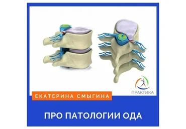 [Центр Практика] ПРО патологии ОДА (Екатерина Смыгина)