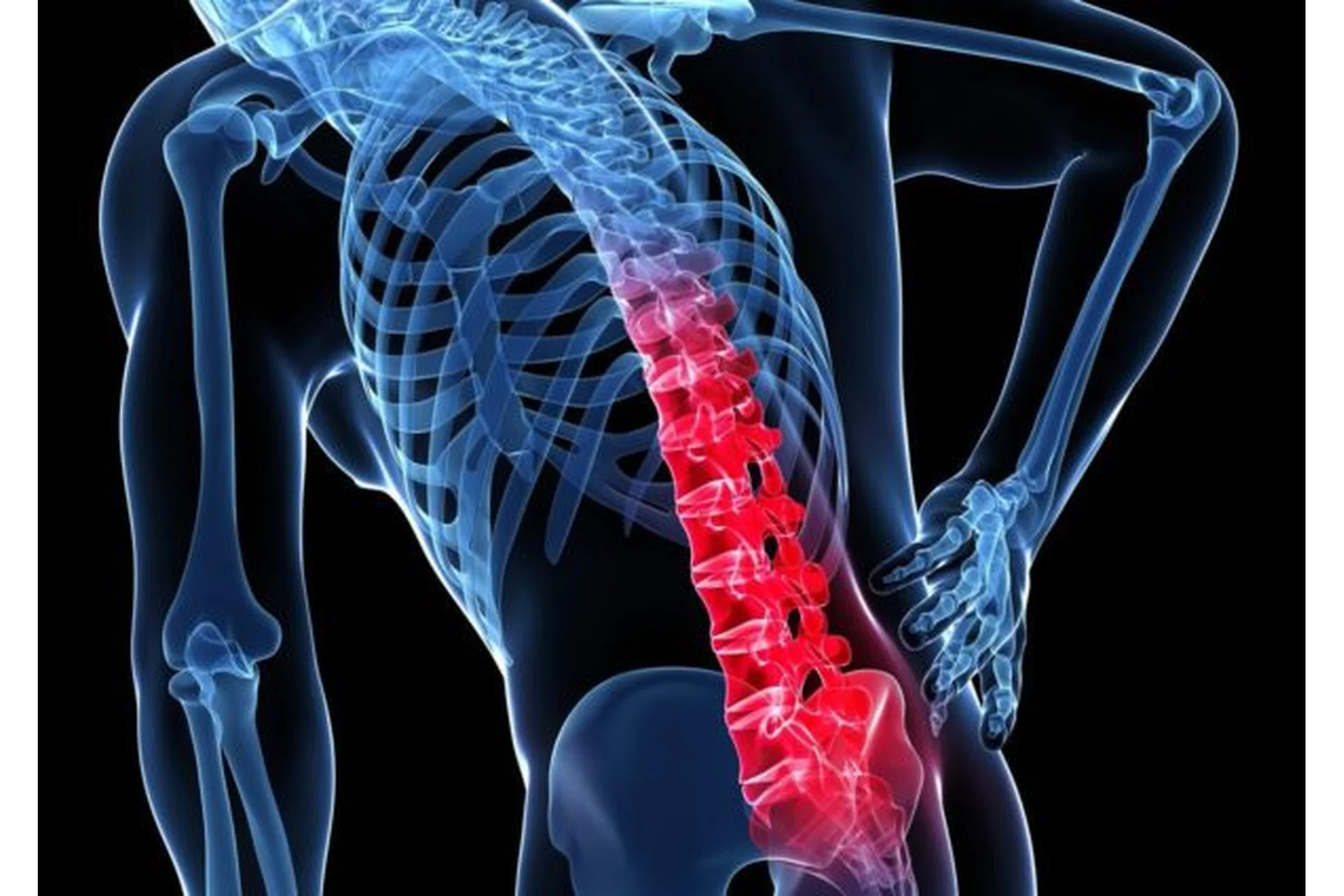 Осанка и боль в спине. Обучающий марафон для тренеров (Антон Шапочка), фото 1 из 1.