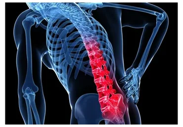 Осанка и боль в спине. Обучающий марафон для тренеров (Антон Шапочка)
