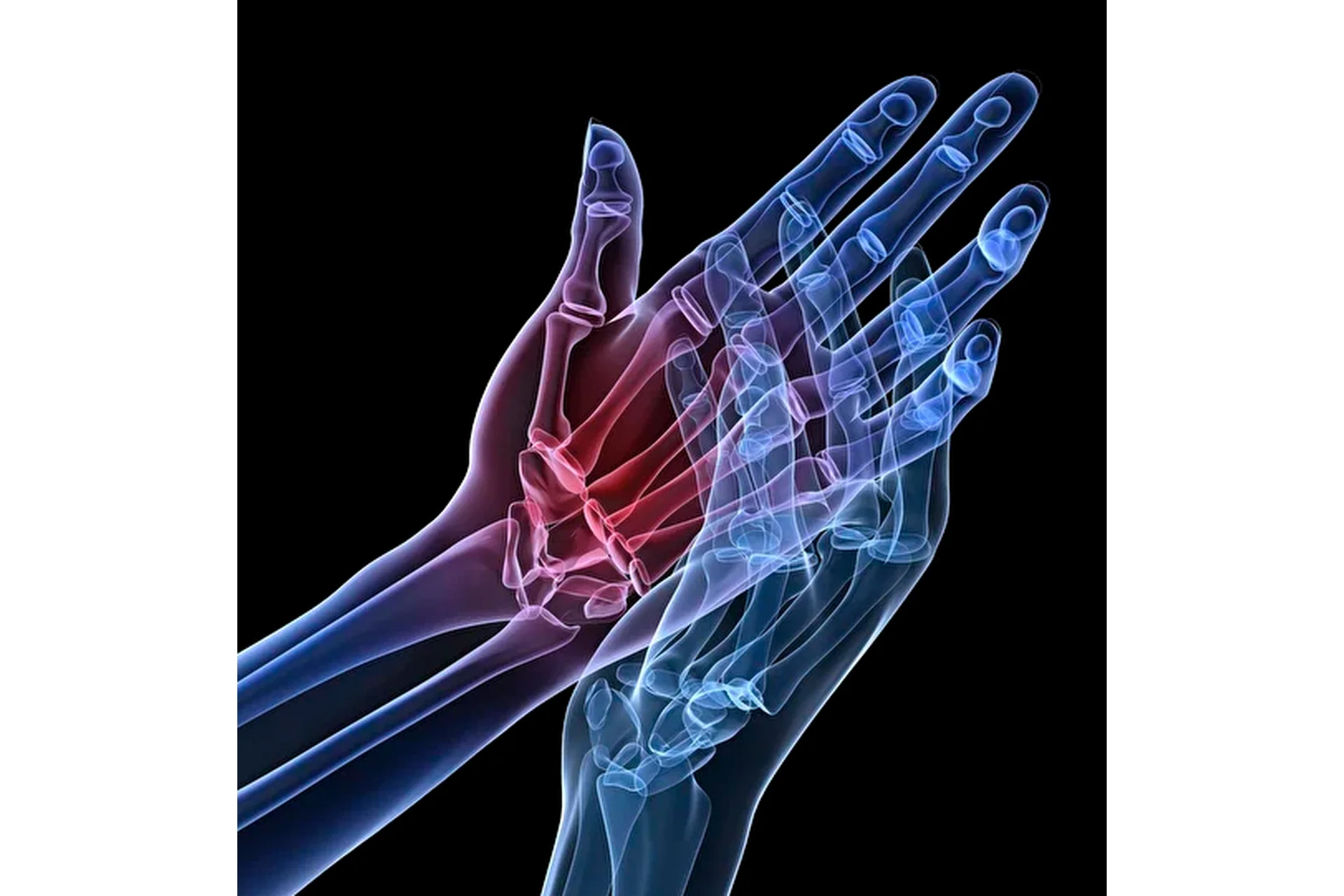 [Kinesioprofi] Дисфункции лучезапястного сустава и кисти (Вячеслав Пичугин), фото 1 из 1.