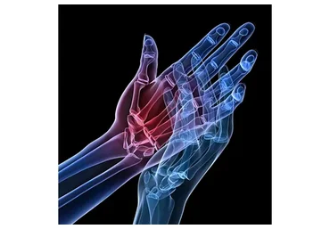 [Kinesioprofi] Дисфункции лучезапястного сустава и кисти (Вячеслав Пичугин)