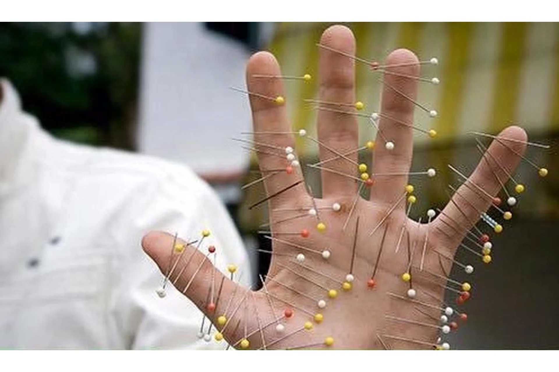 Ло-точки. Ло-каналы (Ван Вэй), фото 1 из 1.