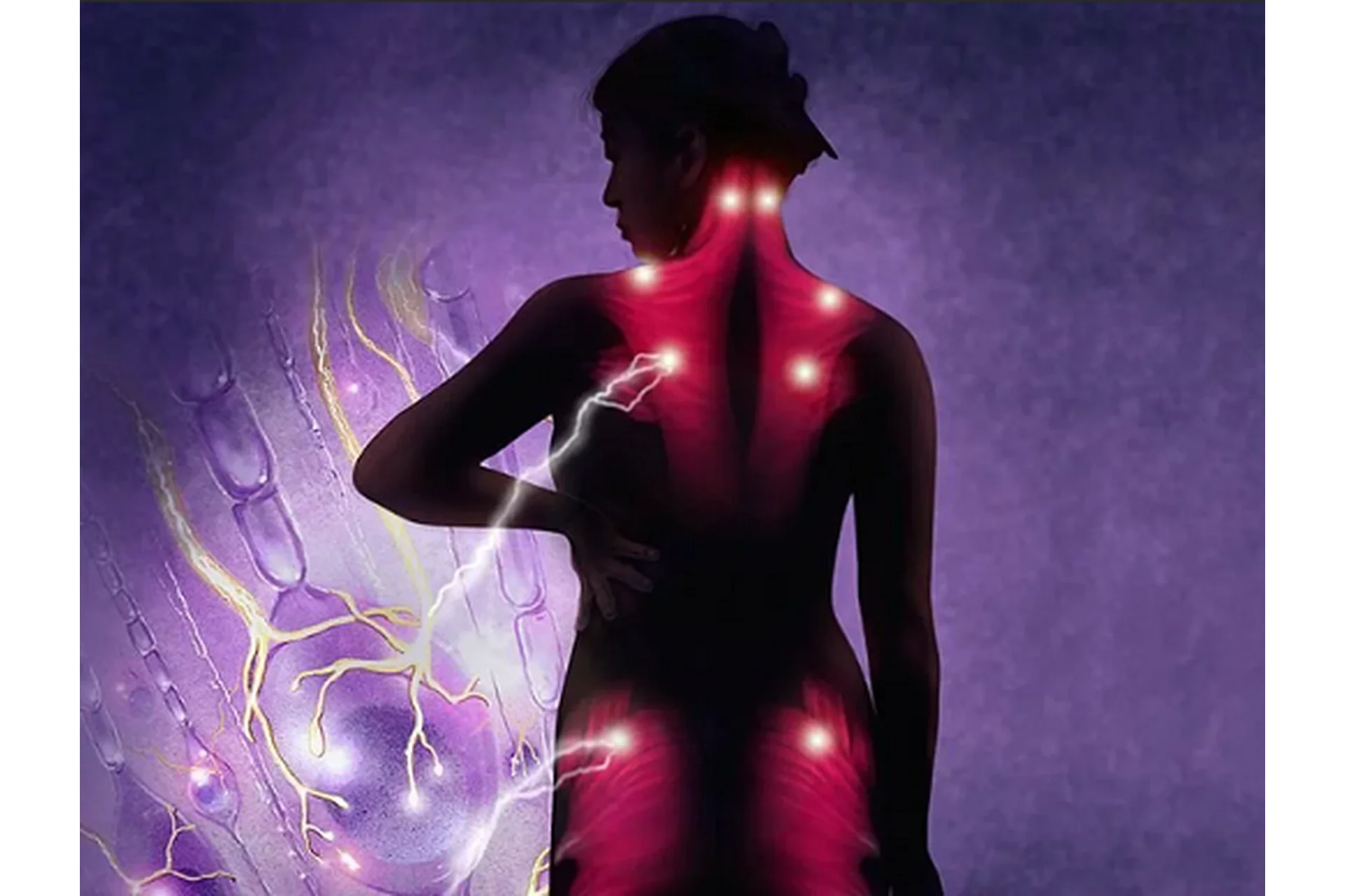 Мышечные зажимы (Татьяна Дудина), фото 1 из 1.