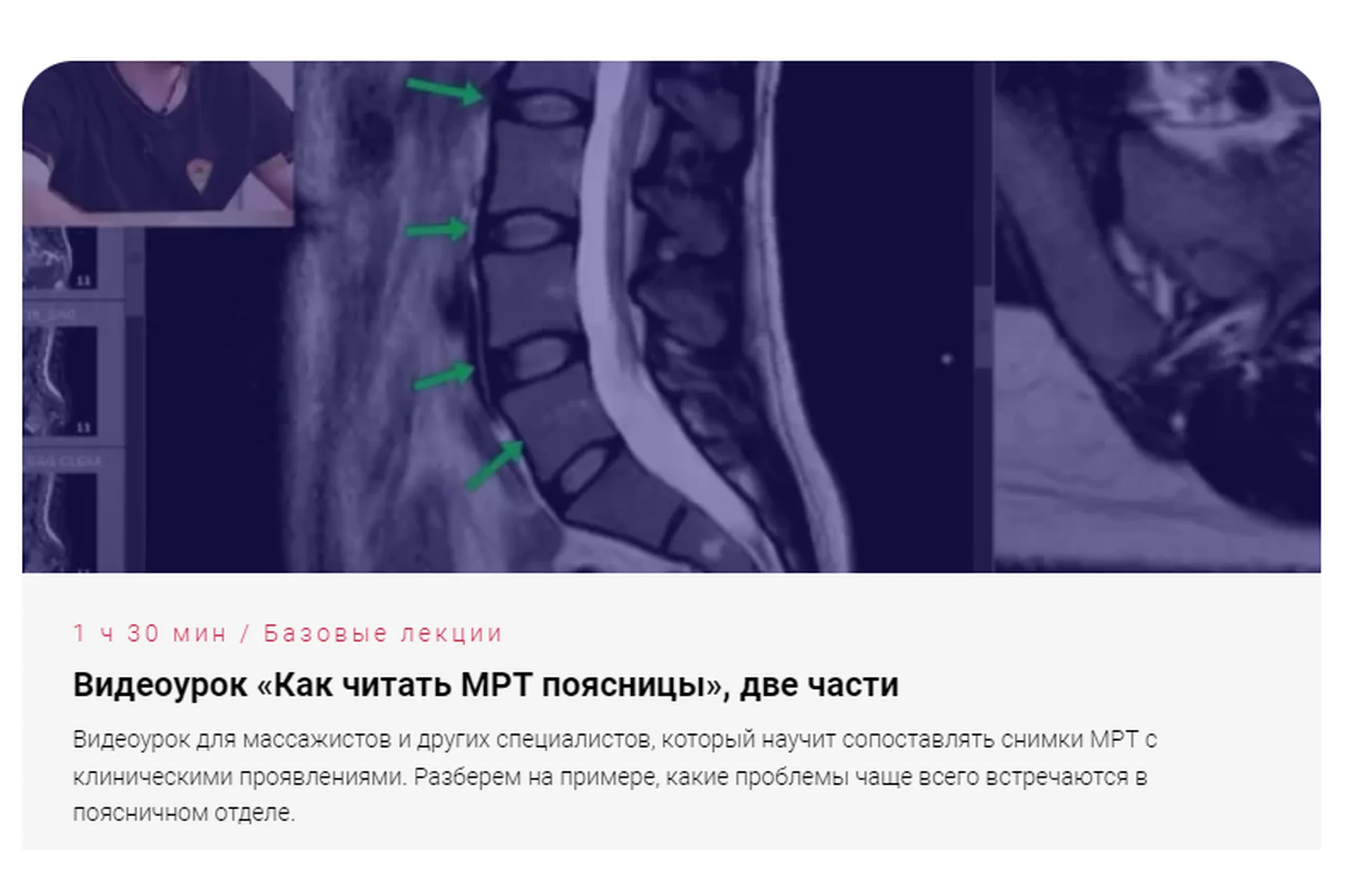 [Доктор Епифанов] Как читать МРТ поясницы, две части (Антон Епифанов), фото 1 из 1.