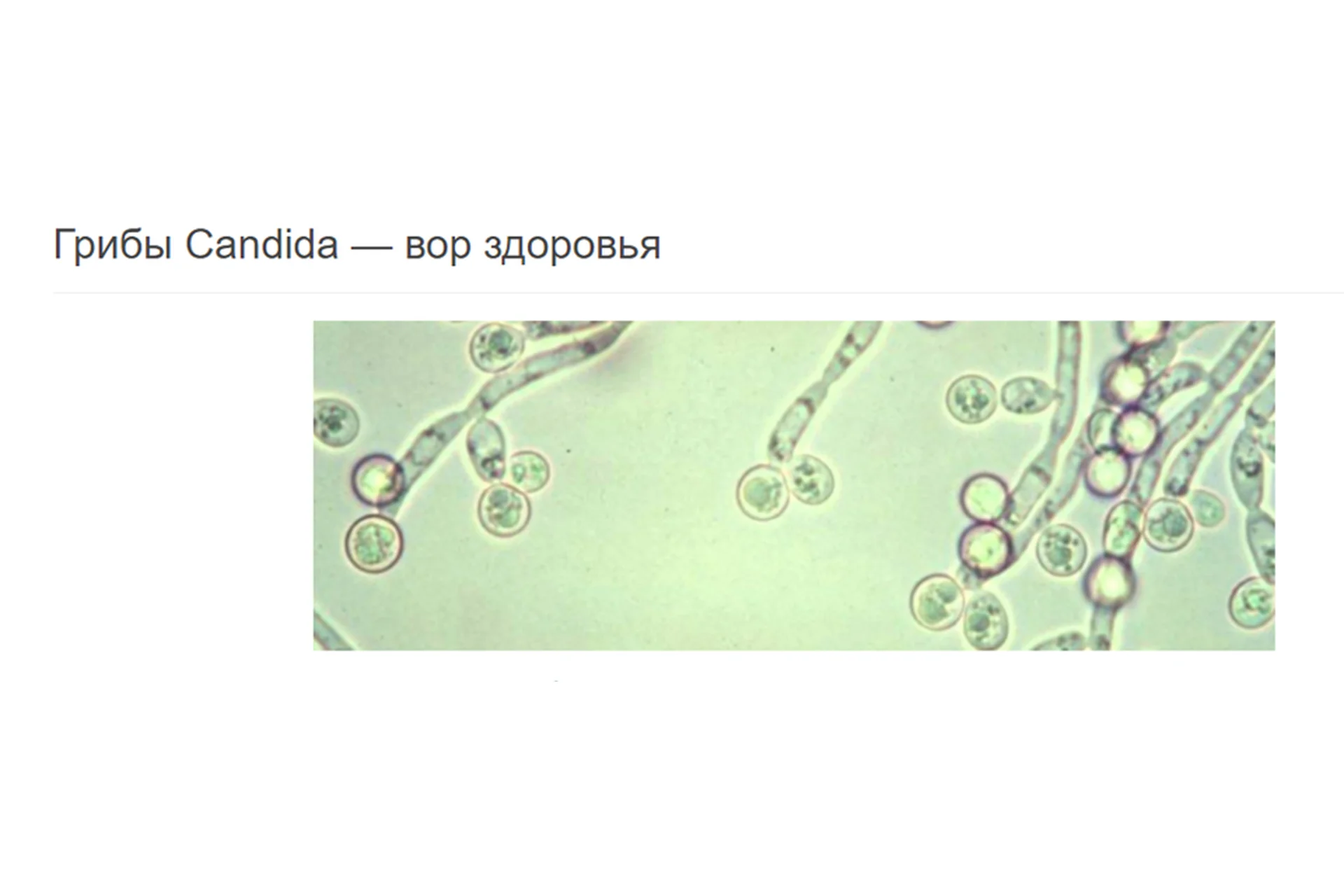 Противогрибковая, противопаразитарная программы (Елена Бахтина), фото 1 из 1.