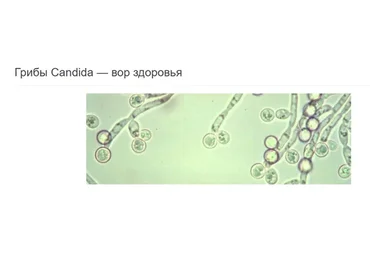 Противогрибковая, противопаразитарная программы (Елена Бахтина)