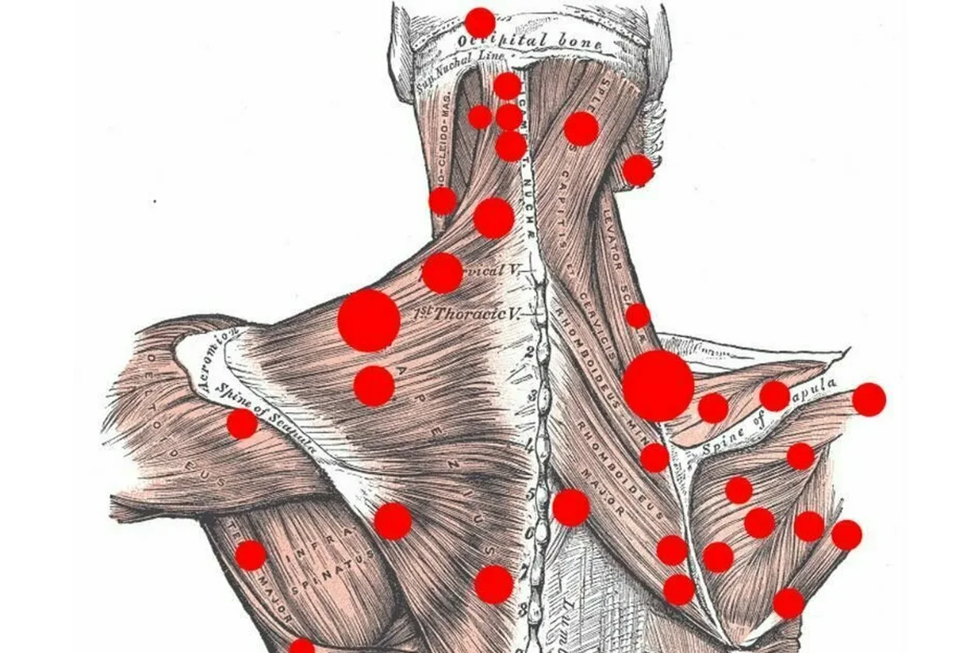 [Grand secret] Триггерные точки (Максим Волков), фото 1 из 1.