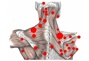 [Grand secret] Триггерные точки (Максим Волков)