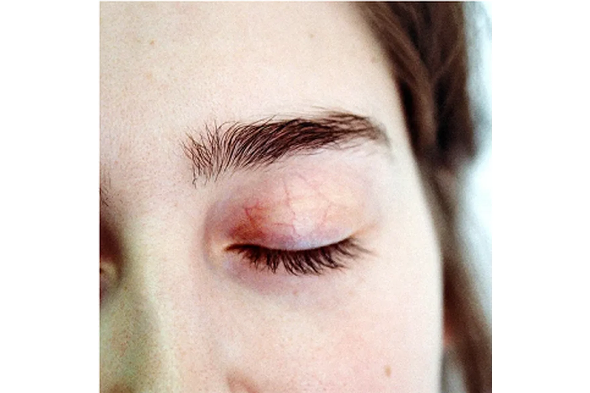 Избавься от анемии (Тимофей Кармацкий), фото 1 из 1.