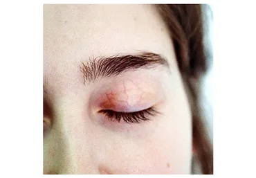 Избавься от анемии (Тимофей Кармацкий)