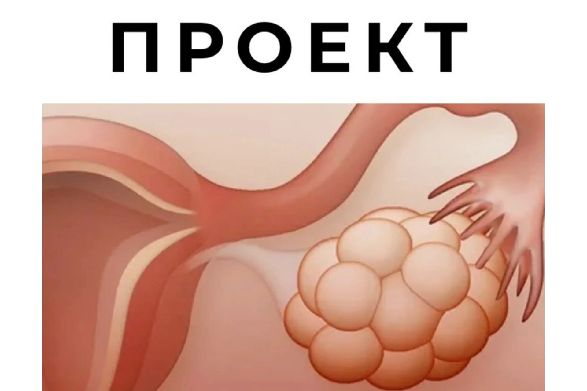 Спкя и другие нарушения менструального цикла (Гала Гарбузова), фото 1 из 1.