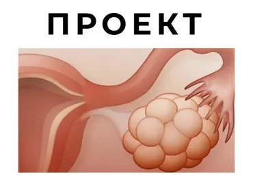 Спкя и другие нарушения менструального цикла (Гала Гарбузова)