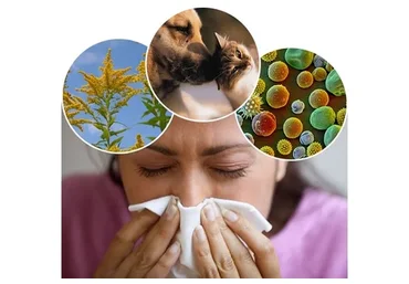 [Интераура] Лечение и профилактика: Аллергия