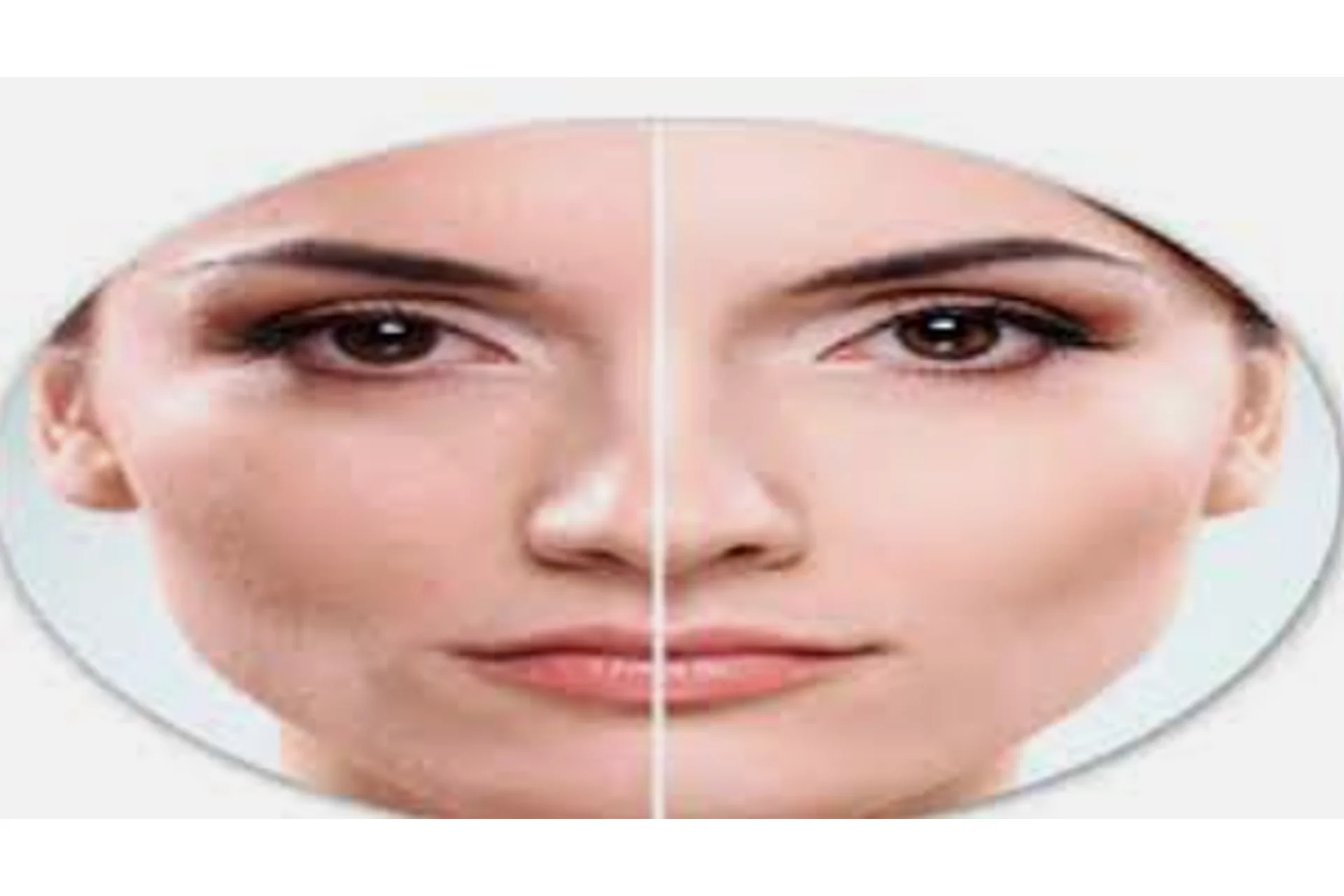 Биомеханика старения лицевых мышц. Самомассаж (Татьяна Шубина), фото 1 из 1.