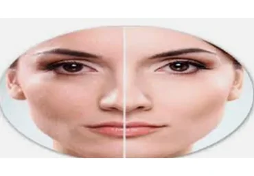 Биомеханика старения лицевых мышц. Самомассаж (Татьяна Шубина)