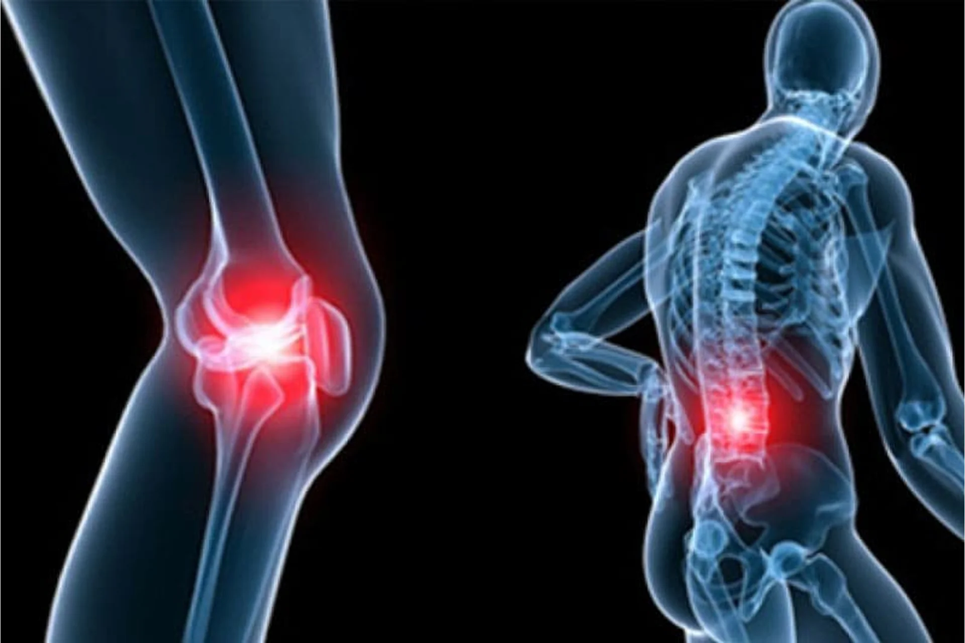 [Центр Шерома] Всё о здоровых суставах и здоровом связочном аппарате (Ульвия Голденбрук), фото 1 из 1.