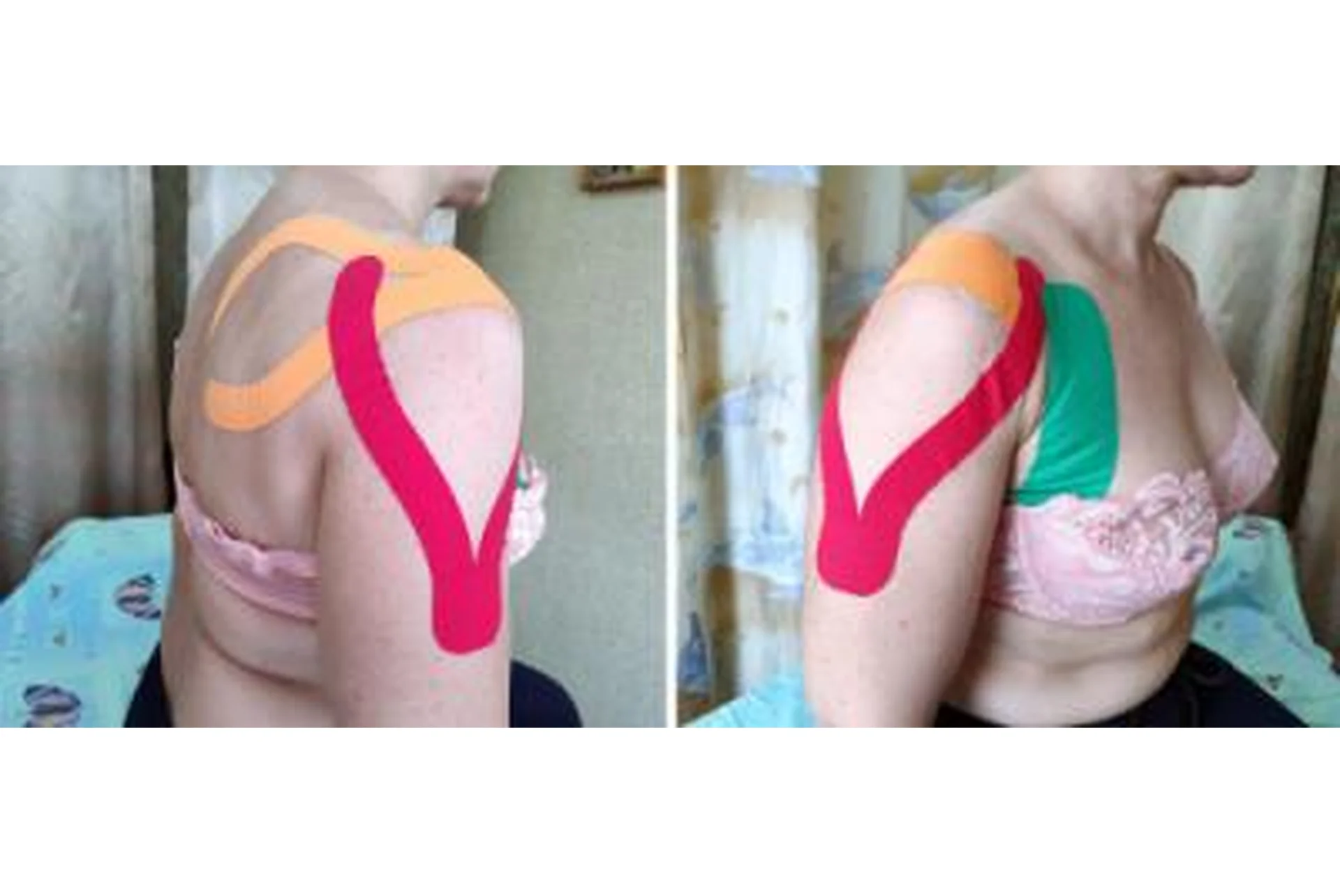 Динамическое тейпирование в практике мануальной терапии (Фидель Субботин), фото 1 из 1.