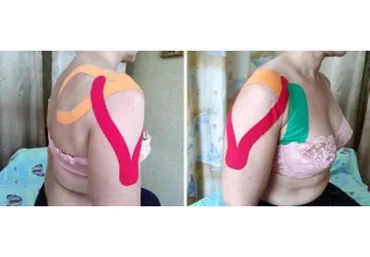 Динамическое тейпирование в практике мануальной терапии (Фидель Субботин)