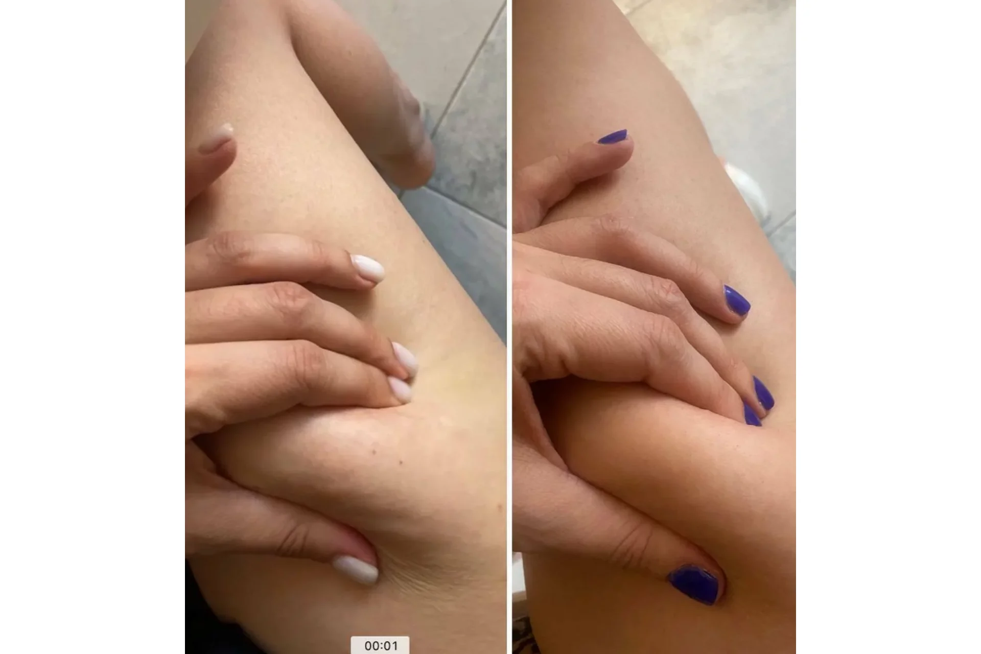 Антидряблость (Оксана Килина), фото 1 из 1.