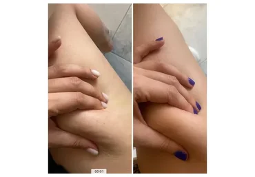 Антидряблость (Оксана Килина)