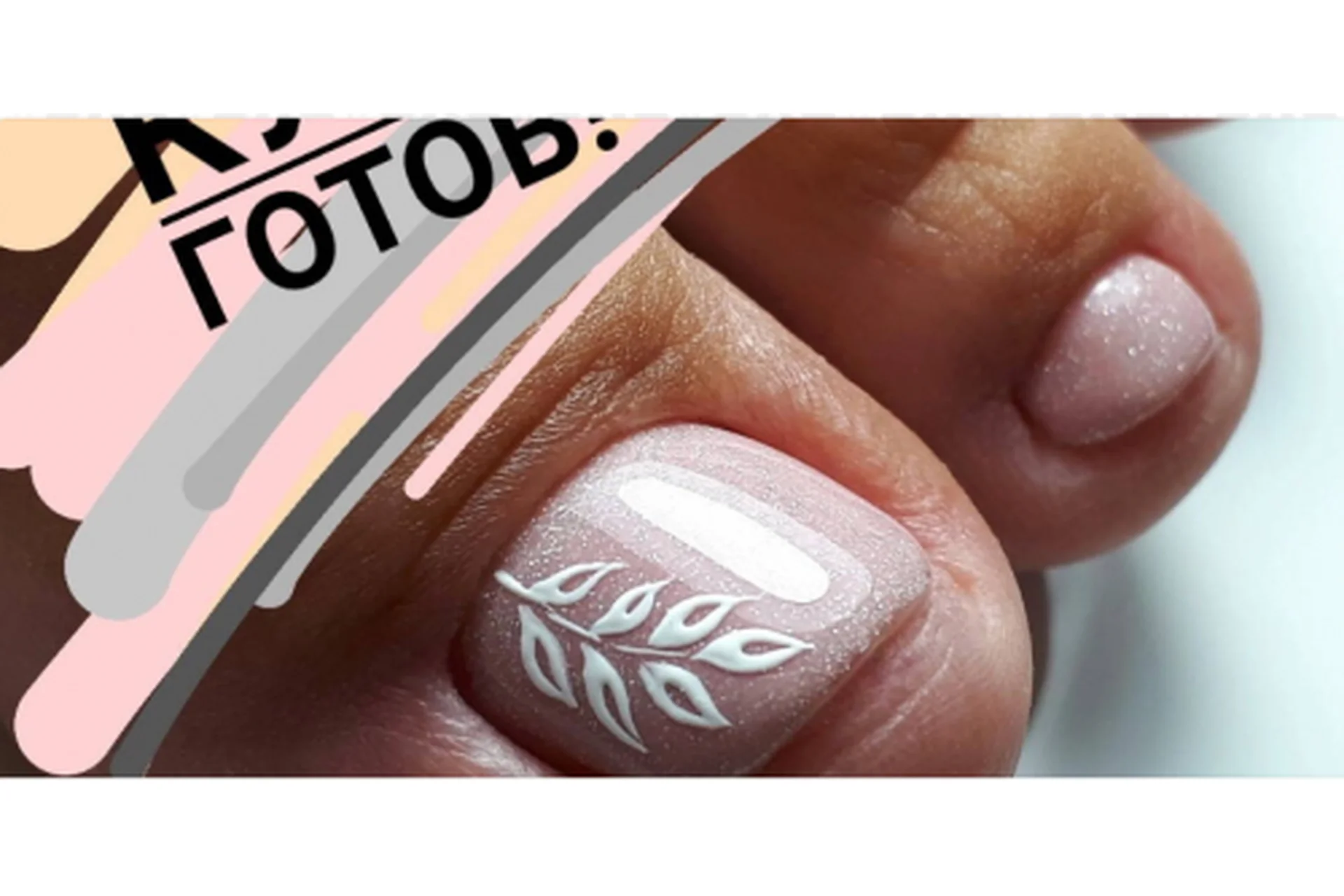 Обработка стопы и трещин смарт-диском (Анастасия Масло), фото 1 из 1.