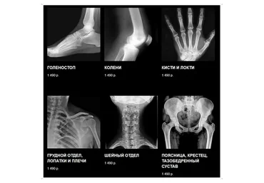 Полный курс ЛФК. Все 6 лекций (Виктор Блуд, Владимир Демченко)